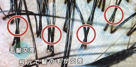 髪の毛のツヤ感 まとまりが劇的に改善する頭皮専用ブラシ 恵比寿の美容室 美容院 Nove Lina オフィシャルホームページ